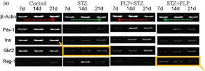 Retraction: Pyridoxal 5′ phosphate protects islets against streptozotocin-induced beta-cell dysfunction – in vitro and in vivo